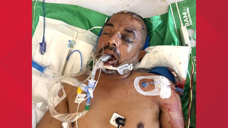 University Hospital asks for help identifying unconscious patient hit by truck Saturday evening — KENS 5 (San Antonio), Sonoma Health news